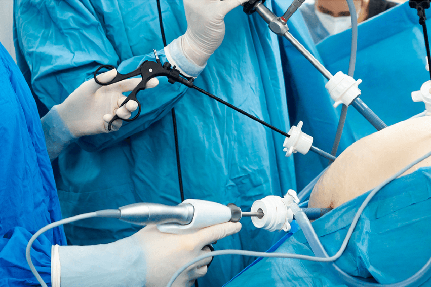 Surgeries